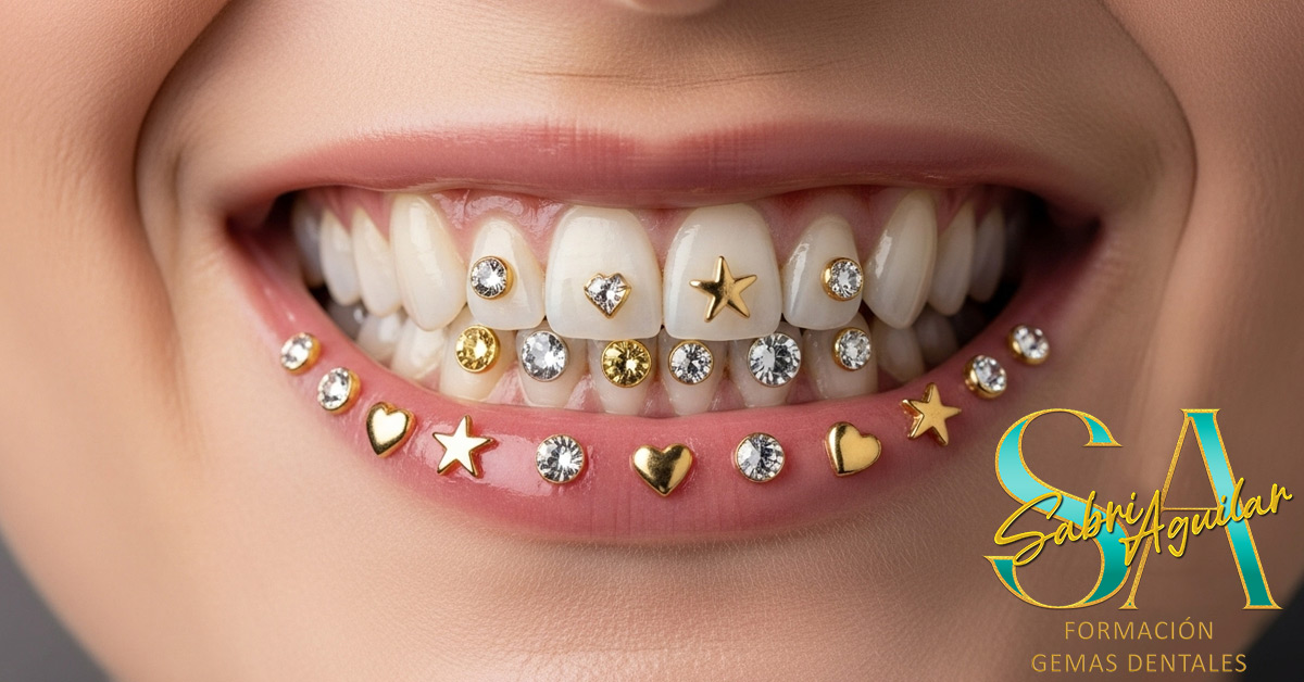 Preguntas Frecuentes Sobre Gemas Dentales en 2025: Todo lo que Necesitas Saber