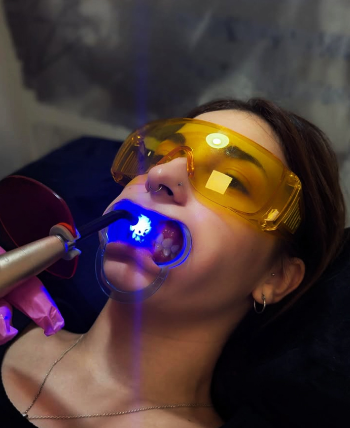 Qué tipo de gemas puedo elegir