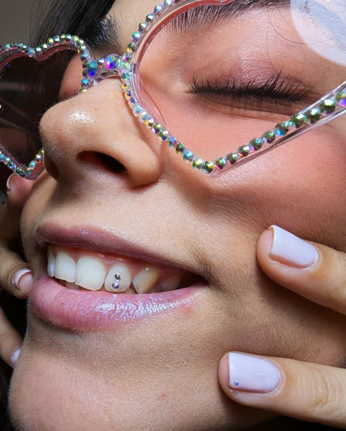 La aplicación de gemas dentales es una disciplina que combina arte precisión y ciencia