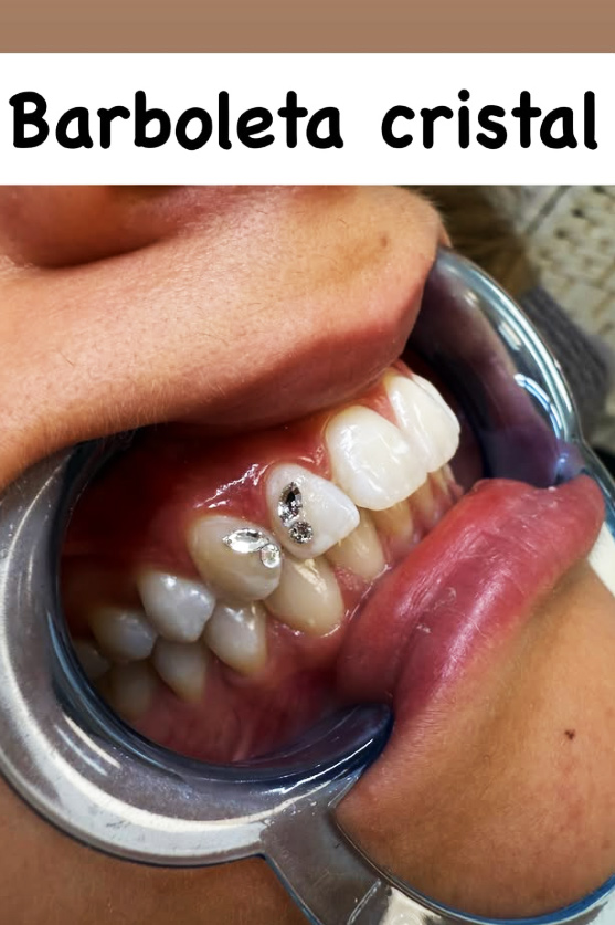 La rentabilidad de las gemas dentales es uno de los mayores atractivos