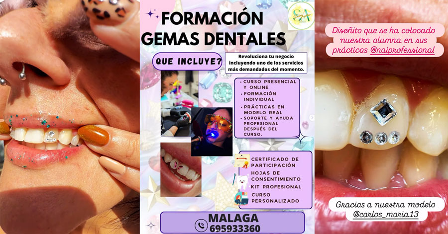 Más Allá del Brillo - La Guía Definitiva sobre Estilos Materiales y Mitos de las Gemas Dentales en 2025