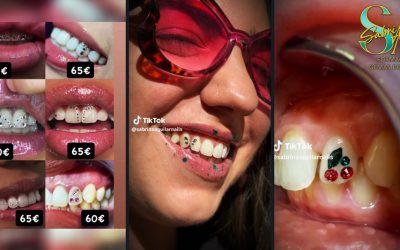 Gemas Dentales en 2026: El servicio más rentable de la estética | Sabri Aguilar