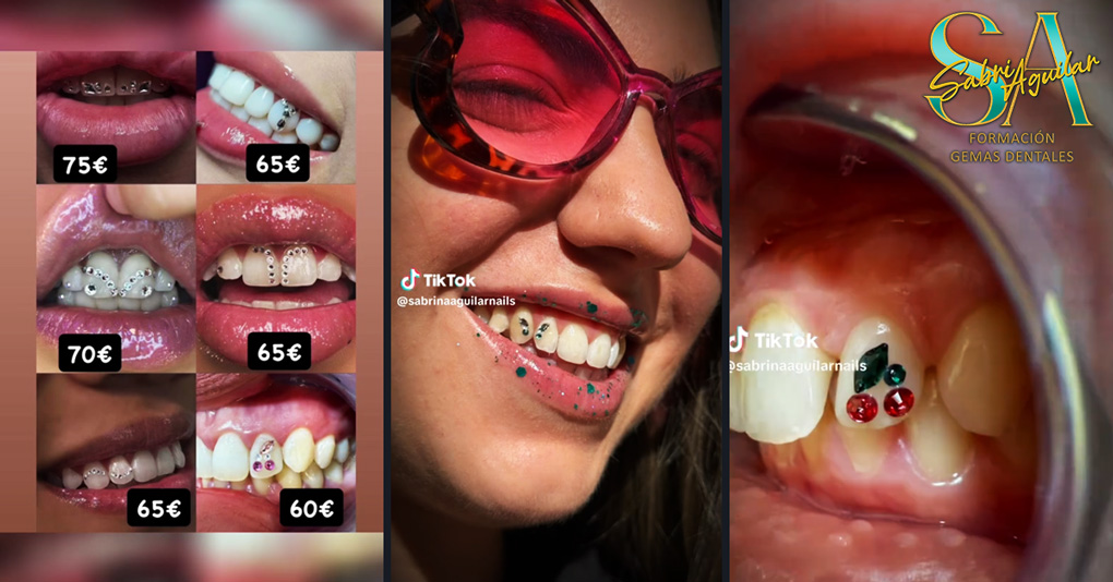 Gemas Dentales en 2026: El servicio más rentable de la estética | Sabri Aguilar