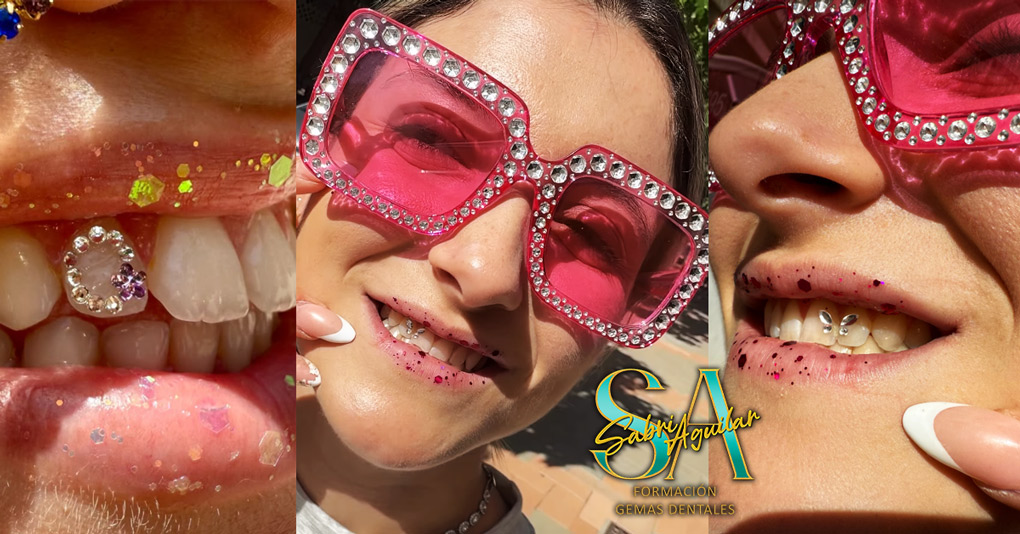 Gemas Dentales en 2026 - Tendencias Seguridad y Cómo Emprender