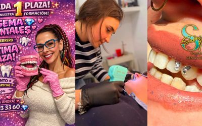La Revolución de las Gemas Dentales: Tu Sonrisa Brillante y Todo lo que Debes Saber en 2026