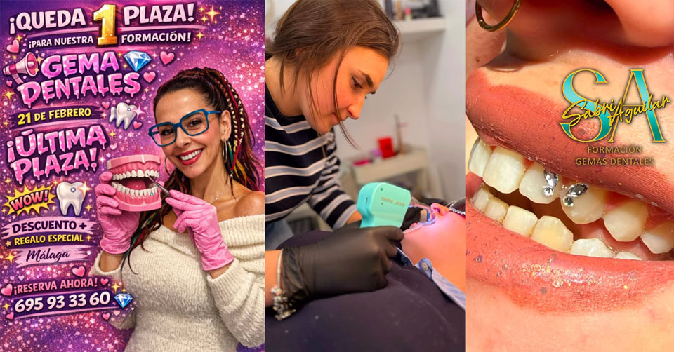 La Revolución de las Gemas Dentales: Tu Sonrisa Brillante y Todo lo que Debes Saber en 2026