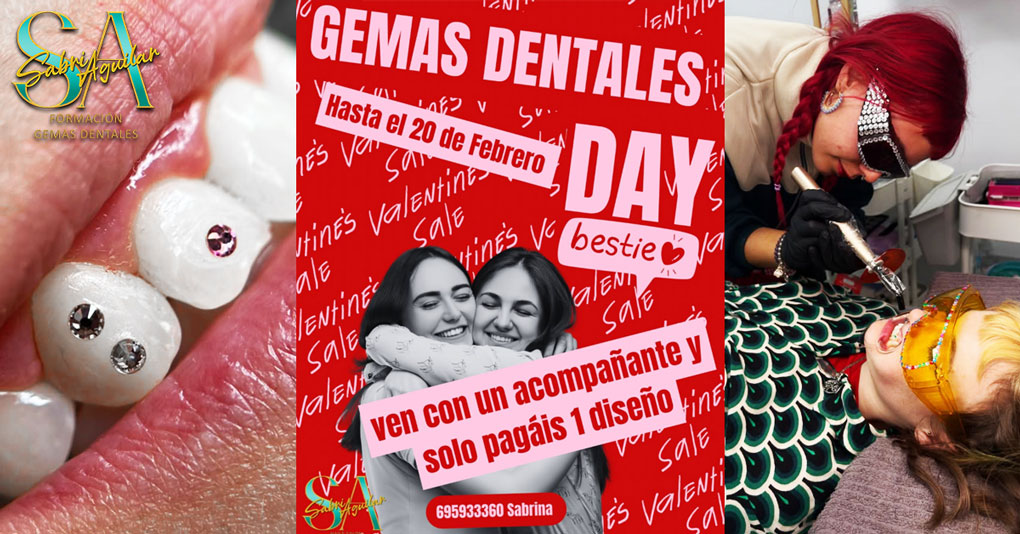 Tooth Gems en 2026 - Por qué la Calidad Premium y la Técnica de Micro-Bonding son el Futuro de tu Facturación