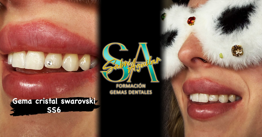 Cómo Multiplicar tus Ingresos en 2026 con las Gemas Dentales: La Guía Definitiva