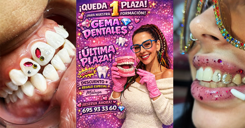 Guía Completa de Gemas Dentales 2026 - De Tendencia Estética a Negocio Rentable (Formación y Consejos)